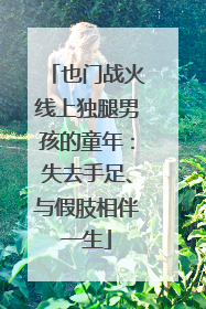 也门战火线上独腿男孩的童年：失去手足、与假肢相伴一生